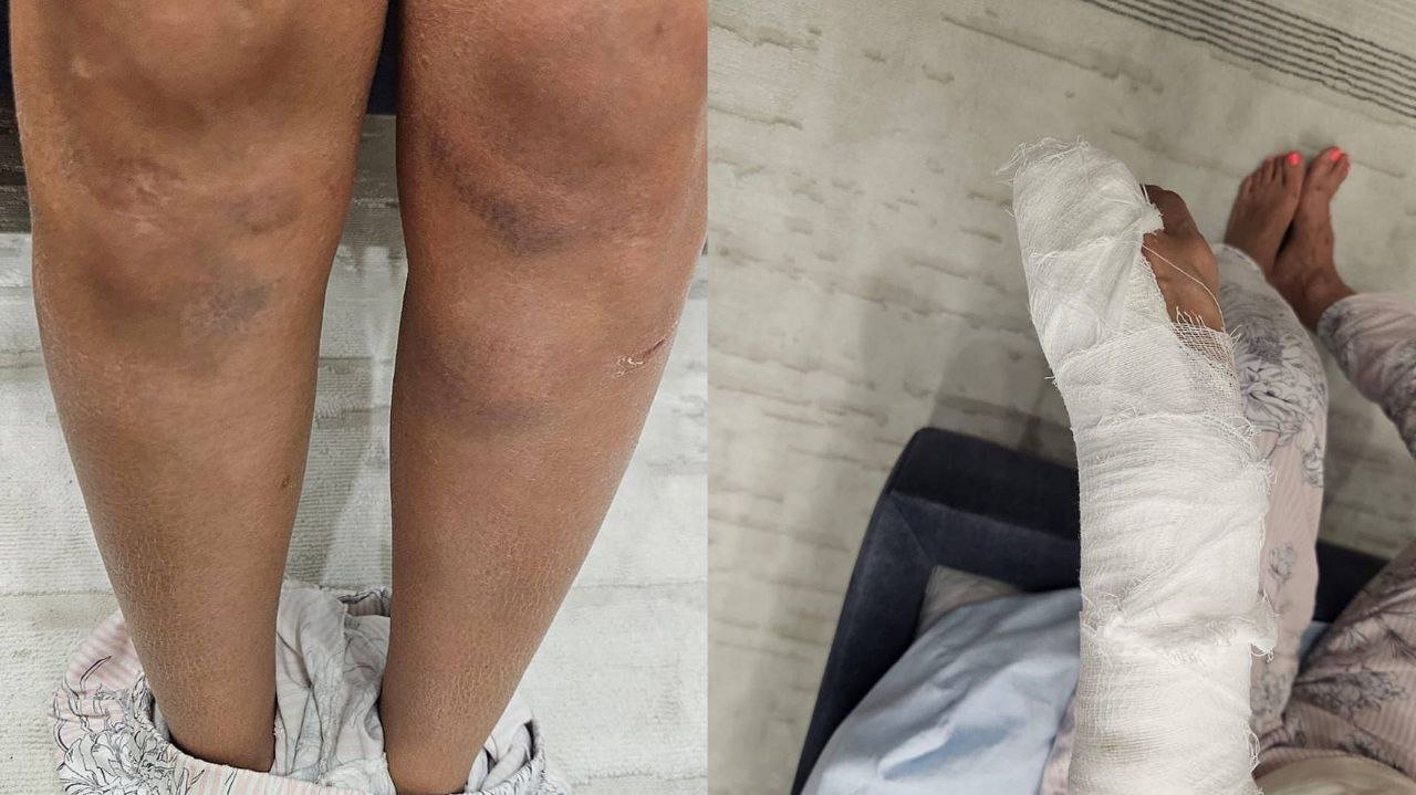 Ð¤Ð¾ÑÐ¾ Ð¿Ð¾Ð±Ð¾ÐµÐ² ÐÐ°Ð´Ð¸Ð½Ñ. ÐÐ¿ÑÐ±Ð»Ð¸ÐºÐ¾Ð²Ð°Ð»Ð¸ Egov.press