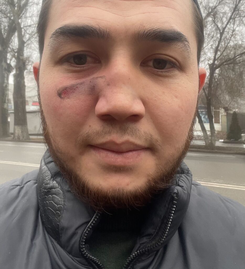 Полицейский произвол: как журналисты Orda.kz получили ранения и приводы в полицию