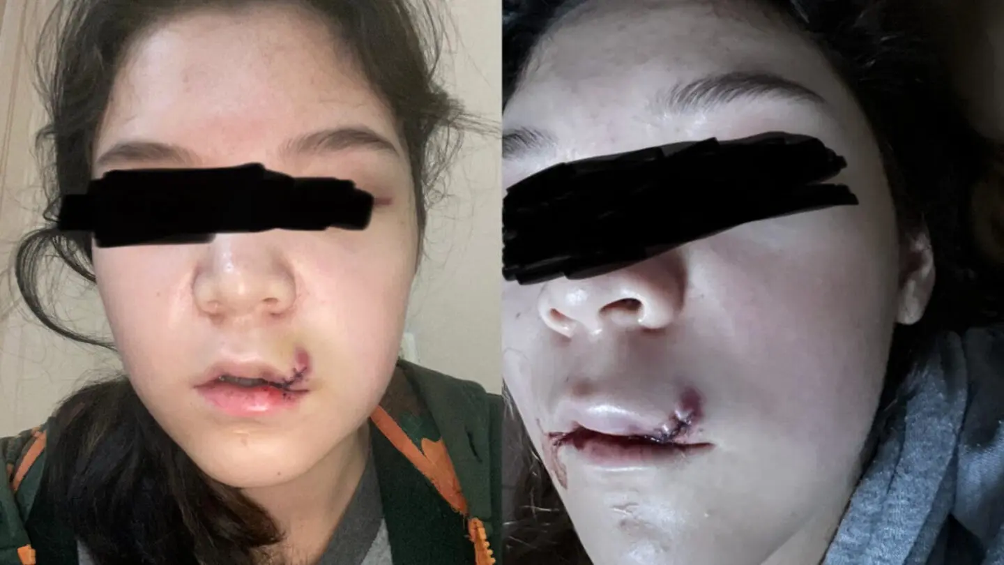 Студентка КарГУ избила школьницу — мать сделала заявление